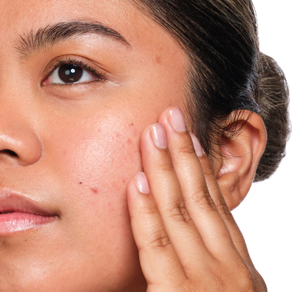 The Ordinary Salicylic Acid 2% Solution